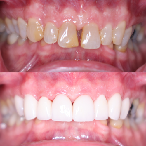 Cosmetic Dentistry